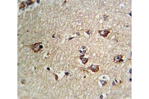 IHC analysis of FFPE human brain tissue stained with CD71 antibody (Transferrin Receptor Antikörper  (AA 649-677))