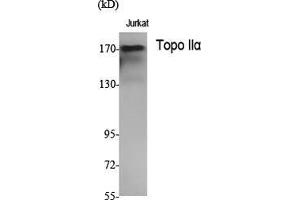 Western Blot (WB) analysis of specific cells using Topo IIalpha Polyclonal Antibody. (Topo IIalpha (N-Term) Antikörper)