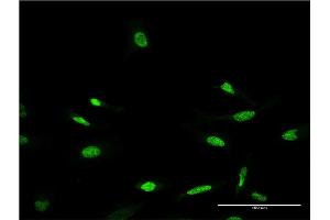 Immunofluorescence of monoclonal antibody to CRX on HeLa cell. (CRX Antikörper  (AA 1-299))