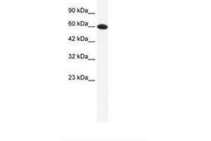 Image no. 1 for anti-DEAD (Asp-Glu-Ala-Asp) Box Polypeptide 6 (DDX6) (AA 74-123) antibody (ABIN202614) (DDX6 Antikörper  (AA 74-123))