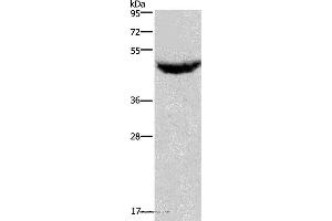 Western blot analysis of Human serum solution, using CXCR2 Polyclonal Antibody at dilution of 1:125 (CXCR2 Antikörper)