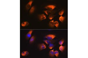 Immunofluorescence analysis of U-251MG cells using M1 Rabbit mAb (ABIN7265448) at dilution of 1:100 (40x lens). (AP2M1 Antikörper)