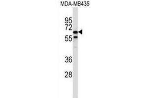 Western Blotting (WB) image for anti-Tripartite Motif Containing 39 (TRIM39) antibody (ABIN2997337) (TRIM39 Antikörper)