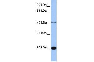 WB Suggested Anti-C2orf68 Antibody Titration: 0. (C2orf68 Antikörper  (N-Term))