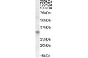 Image no. 1 for anti-Four and A Half LIM Domains 2 (FHL2) (C-Term) antibody (ABIN374413) (FHL2 Antikörper  (C-Term))