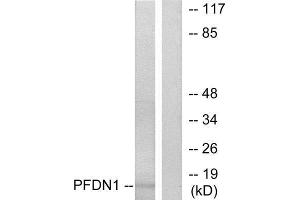 Western Blotting (WB) image for anti-Prefoldin Subunit 1 (PFDN1) (N-Term) antibody (ABIN1849016) (PFDN1 Antikörper  (N-Term))