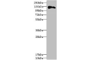 Western blot All lanes: ANLNantibody at 3. (Anillin Antikörper  (AA 845-1124))