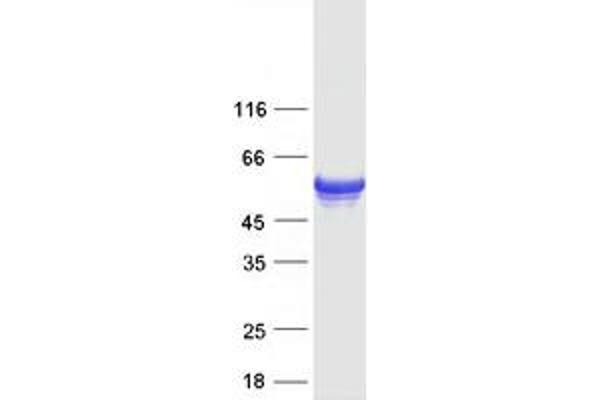 FAD Synthetase Protein (Transcript Variant 2) (Myc-DYKDDDDK Tag)