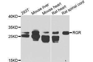 Western blot analysis of extracts of various cell lines, using RGR antibody. (RGR Antikörper)