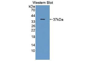 Western blot analysis of the recombinant protein. (OTUB1 Antikörper  (AA 1-271))