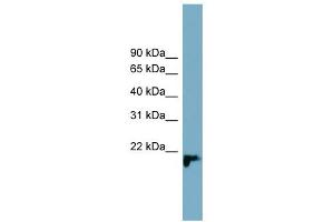 WB Suggested Anti-C1orf93 Antibody Titration: 0. (C1orf93 Antikörper  (Middle Region))