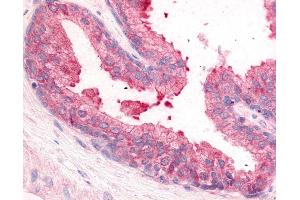 Anti-PDE8A antibody IHC of human prostate. (PDE8A Antikörper  (N-Term))