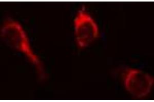 ABIN6267652 staining A431 cells by IF/ICC. (PKC mu Antikörper  (pTyr463))