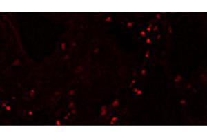 Frozen skin section from piglets immunized with an inactivated chimeric PCV1-2 vaccine post intradermal injection with PCV2 antigen was stained with Mouse Anti-Porcine CD4-PE (CD4 Antikörper  (PE))