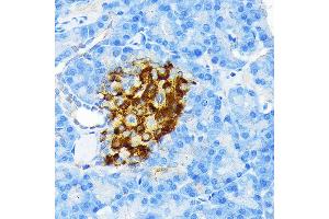 Immunohistochemistry of paraffin-embedded rat pancreatic islet using Insulin Rabbit mAb (ABIN7267886) at dilution of 1:100 (40x lens). (Insulin Antikörper)