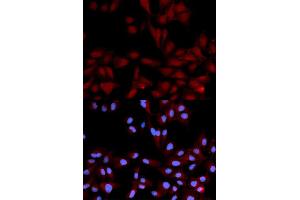Immunofluorescence analysis of U2OS cells using Phospho-MAPK14-Y182 antibody (ABIN5969911). (MAPK14 Antikörper  (pTyr182))