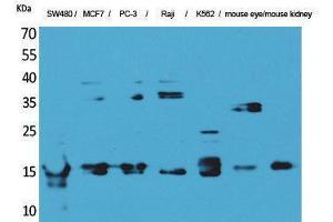 Western Blotting (WB) image for anti-MK (Internal Region) antibody (ABIN3180994) (MK (Internal Region) Antikörper)