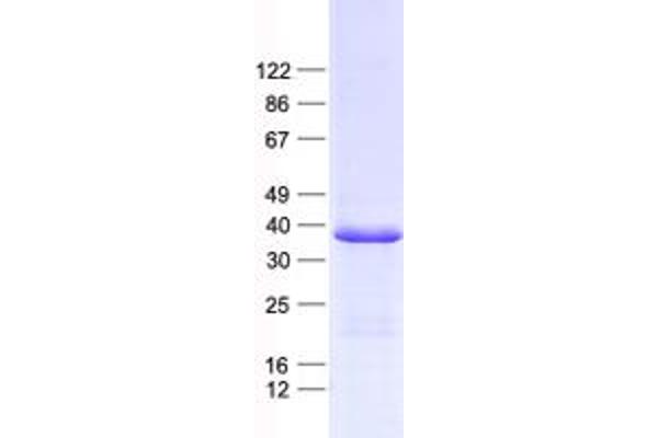 MRPL44 Protein (His tag)