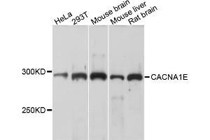 Western blot analysis of extracts of various cell lines, using CACNA1E antibody (ABIN4903099) at 1:1000 dilution. (CACNA1E Antikörper)