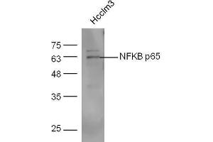 NF-kB p65 Antikörper  (AA 51-100)