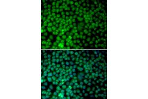 Immunofluorescence analysis of MCF-7 cells using RBX1 antibody (ABIN5970933). (RBX1 Antikörper)