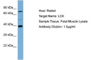 Host: Rabbit Target Name: LCK Sample Type: Fetal Muscle lysates Antibody Dilution: 1. (LCK Antikörper  (N-Term))