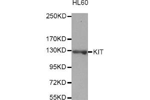 Western blot analysis of extracts of HL-60 cells, using KIT antibody (ABIN3049466). (KIT Antikörper)