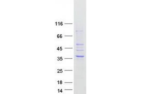 HSD17B13 Protein (Transcript Variant A) (Myc-DYKDDDDK Tag)