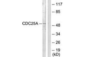 Western Blotting (WB) image for anti-Cell Division Cycle 25 Homolog A (S. Pombe) (CDC25A) (AA 90-139) antibody (ABIN2888800) (CDC25A Antikörper  (AA 90-139))