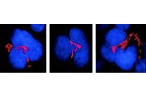 FKBP51 Immunofluorescence. (FKBP5 Antikörper)