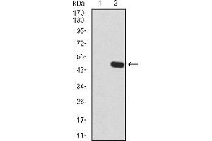 Western Blotting (WB) image for anti-Zinc Finger Protein GLI1 (GLI1) (AA 284-449) antibody (ABIN5866847) (GLI1 Antikörper  (AA 284-449))