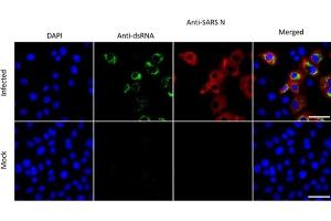 Immunofluorescence (IF) image for anti-SARS-Coronavirus Nucleocapsid Protein (SARS-CoV N) antibody (ABIN6952544)