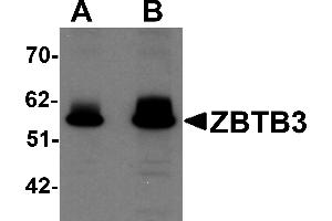 Western Blotting (WB) image for anti-Zinc Finger and BTB Domain Containing 3 (ZBTB3) (C-Term) antibody (ABIN1030811) (ZBTB3 Antikörper  (C-Term))