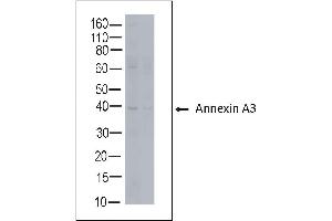 Rabbit anti Annexin A3 on human tonsil lysate (Annexin A3 Antikörper)