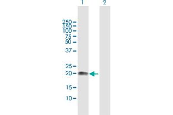 VSTM2L Antikörper  (AA 1-204)