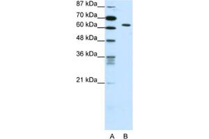 Western Blotting (WB) image for anti-SMAD, Mothers Against DPP Homolog 1 (SMAD1) antibody (ABIN2461769) (SMAD1 Antikörper)