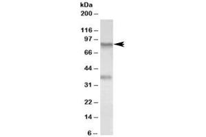 Western blot testing of A549 lysate with VAP-1 antibody at 0. (AOC3 Antikörper)