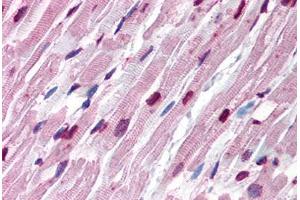 Human Heart (formalin-fixed, paraffin-embedded) stained with Tubulin, Alpha 1 (TUBA1) antibody ABIN239816 at 10 ug/ml followed by biotinylated anti-mouse IgG secondary antibody ABIN481714, alkaline phosphatase-streptavidin and chromogen. (alpha Tubulin Antikörper)