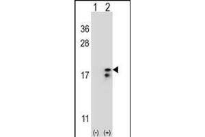 Western blot analysis of COX6A1 (arrow) using rabbit polyclonal COX6A1 Antibody (Center) (ABIN653100 and ABIN2842691). (COX6A1 Antikörper  (AA 50-78))