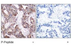 Image no. 1 for anti-Stathmin 1 (STMN1) (pSer24) antibody (ABIN196968) (Stathmin 1 Antikörper  (pSer24))