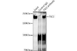 Immunoprecipitation analysis of 300 μg extracts of 293T cells using 3 μg TSC2 antibody (ABIN7271027). (Tuberin Antikörper)