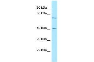 WB Suggested Anti-RTN4RL2 Antibody Titration: 1. (RTN4RL2 Antikörper  (C-Term))