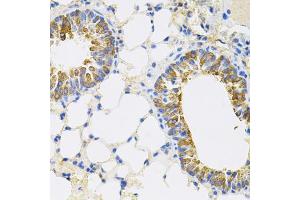 Immunohistochemistry of paraffin-embedded mouse lung using CEACAM5 antibody (ABIN6291892) (40x lens). (CEACAM5 Antikörper)