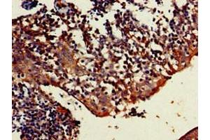 Immunohistochemistry of paraffin-embedded human tonsil tissue using ABIN7173455 at dilution of 1:100 (TRIM5 Antikörper  (AA 1-493))