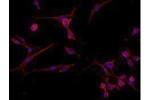 Immunofluorescence (IF) image for Goat anti-Rat IgG antibody (Alexa Fluor 594) (ABIN2667001) (Ziege anti-Ratte IgG Antikörper (Alexa Fluor 594))