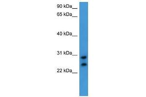 Western Blot showing CEACAM7 antibody used at a concentration of 1-2 ug/ml to detect its target protein. (CEACAM7 Antikörper  (C-Term))