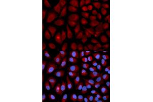 Immunofluorescence analysis of U2OS cells using VIM antibody (ABIN5971408). (Vimentin Antikörper)