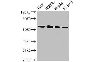 WB analysis of A549 whole cell lysates, HEK293 whole cell lysates, HepG2 whole cell lysates, and Rat Kidney tissue, using P4HA1 antibody (2. (P4HA1 Antikörper  (AA 256-525))