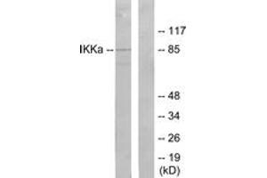 Western blot analysis of extracts from 293 cells, treated with EGF, using IKK-alpha (Ab-23) Antibody. (IKK alpha Antikörper  (AA 15-64))