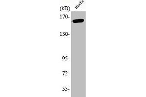 Western Blot analysis of HuvEc cells using Phospho-Flk-1 (Y1175) Polyclonal Antibody (VEGFR2/CD309 Antikörper  (pTyr1175))
